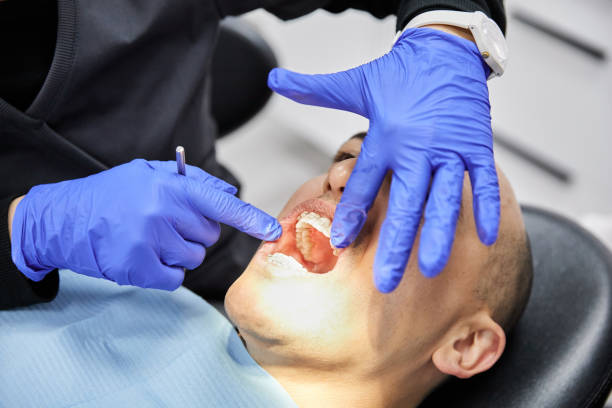 Best Emergency Tooth Extraction  in Affton, MO